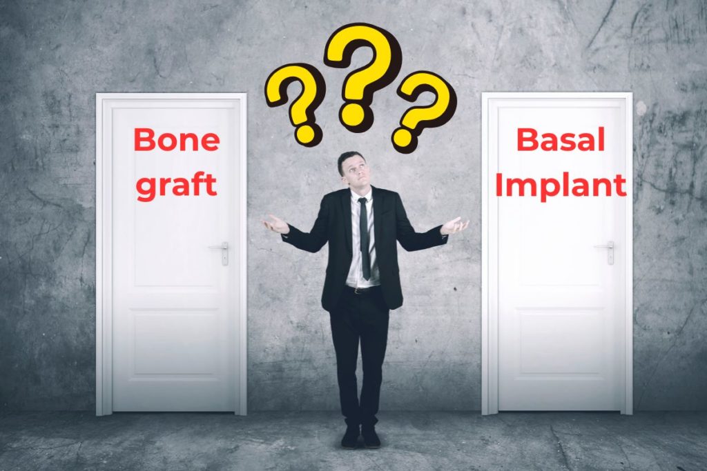 Man choosing between bone graft and basal implant for dental treatment – visual comparison of sinus lift and bone graft alternatives.