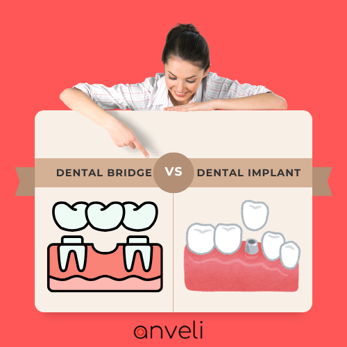 A woman pointing her finger at the table, trying to choose between dental bridge vs implant.