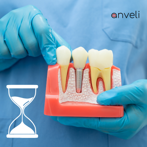 An oral surgeon pointing at dental implants model.