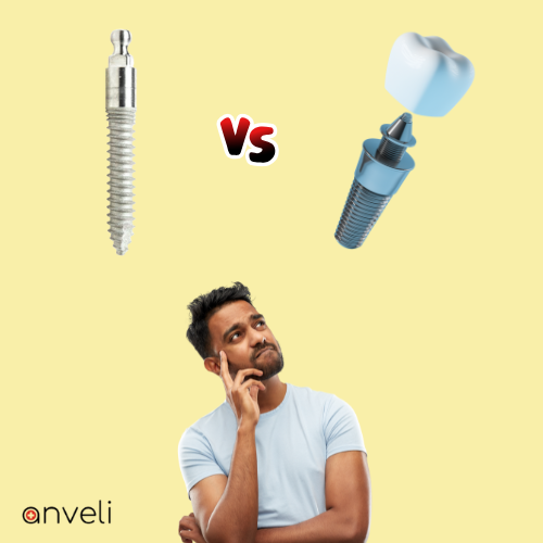 A man making a choice between mini implant and regular implant.