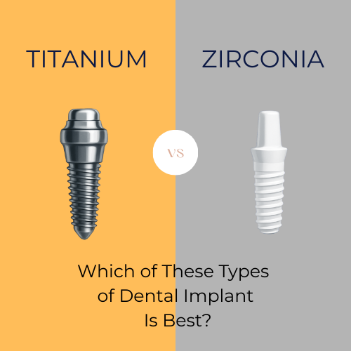 Titanium vs zirconia dental implant visual showing images of both implants.