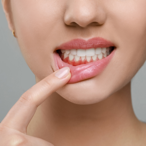 A woman showing her lower gums by pulling her lip down.