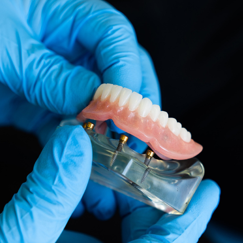 A dental surgeon holding temporary prosthesis.