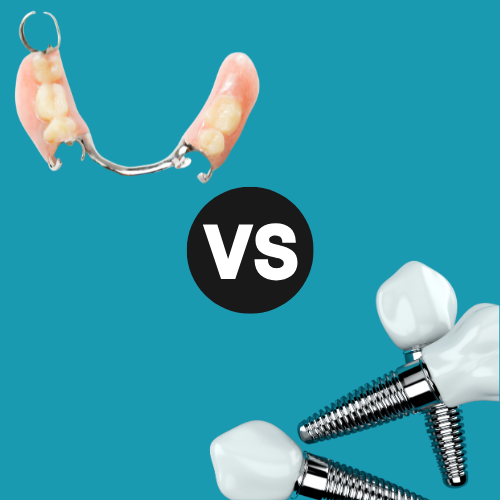 A "vs." visual showing dentures at the top and dental implants at the bottom.